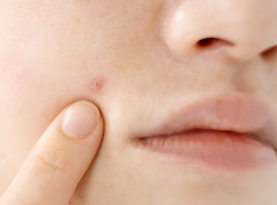 Omnilux（LED光線治療器）